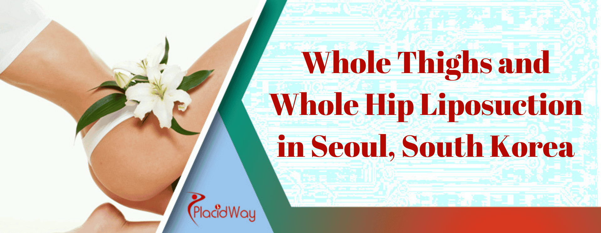 Whole Thighs and Whole Hip Liposuction in Seoul, South Korea